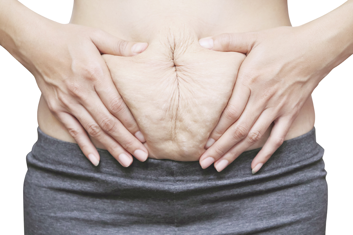 Abdominal Separation During Pregnancy - myHealth bytes