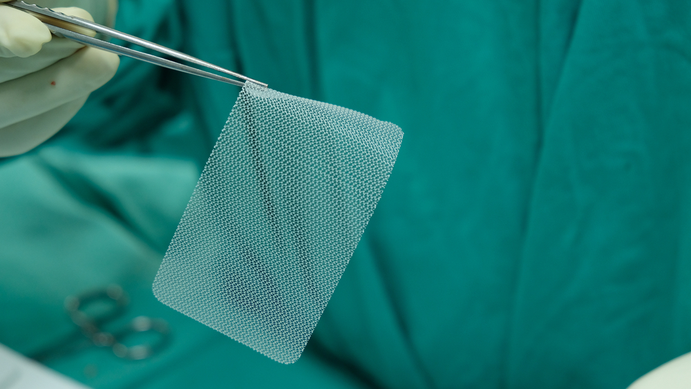 Hernias and surgical repair with mesh implants